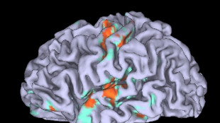 Scoperte le proteine che plasmano le differenze dei cervelli